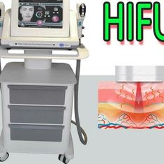 De Schoonheidsmachine van de hoge Intensiteits Geconcentreerde Ultrasone klank HIFU voor Gezichtsbehandeling in Schoonheidssalon
