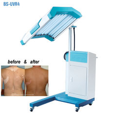 Lichte de Therapiemachine van de Phototherapybehandeling UVB, Narrowband Lichte Therapie van UVB