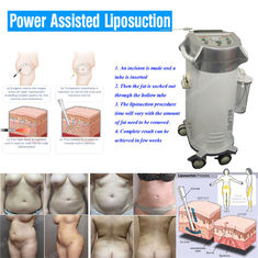 Lichaam Gevormd Macht Bijgestaan Liposuction-Materiaal met geringe geluidssterkte voor het Ziekenhuis