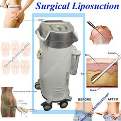 De macht stond het Chirurgische Liposuction-Materiaal van de Machine Buikchirurgie bij