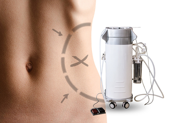 Esthetische Chirurgische Liposuction-Machine voor Buik/Hogere het Vermageringsdieetmachine van de Wapen Chirurgische Zuiging