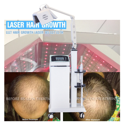 De de Lasertherapie van de haartherapie LLLT kweekt Haar met de Echte Machine van de het Haarhernieuwde groei van de Diodenlaser