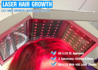 De Laserbehandeling van de 300 Wattskliniek voor Haarverlies, Laag Pijnloos het Haarverlies van de Lasertherapie