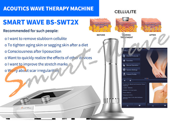 Van de de Akoestische Golftherapie van de schoonheidssalon BS-SWT2X de Verwijdering van de Machinecellulite 1 Jaargarantie