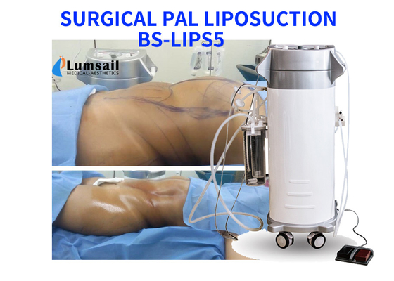 Van het de Machinevermageringsdieet van VRIEND Ultrasoon Chirurgisch Liposuction de Schoonheidsmateriaal met Cannula Reeks
