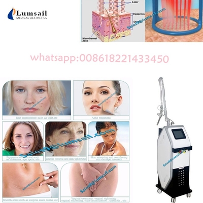 Verwaarloosbare de Lasermachine van gynaecologieco2 voor Vaginal Tightening